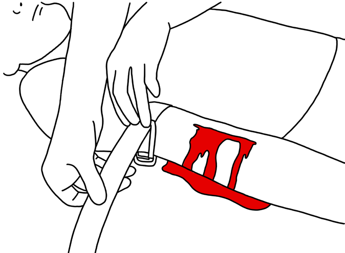 Diagram 10: Tighten tourniquet 3 inches above arm or leg wound.