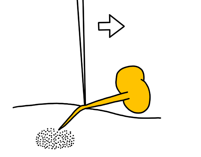 Diagram 13: Flick off a stinger.