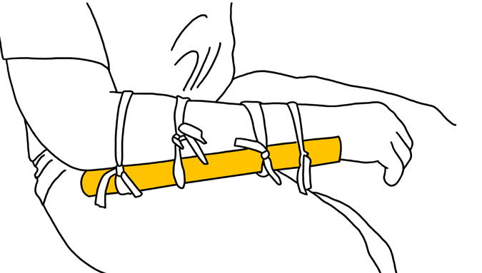 Diagram 16: Hold splint in place with tied cloth.