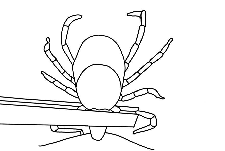Diagram 22: Tweeze tick mouthparts and head close to the skin.