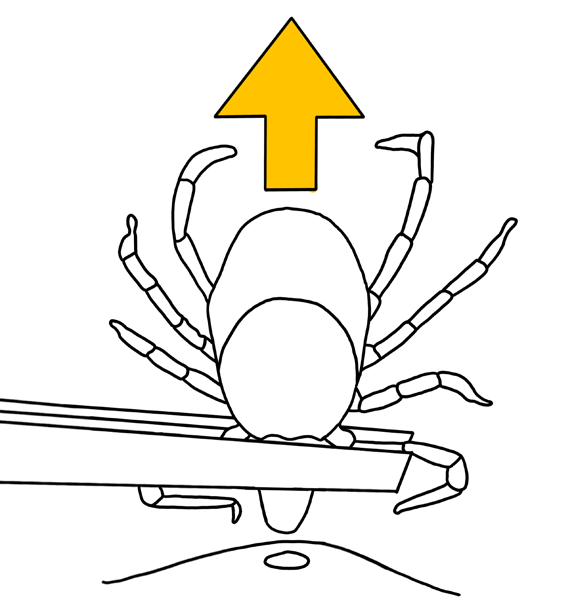 Diagram 23: Slowly lift tick upward until the tick lets go from skin.