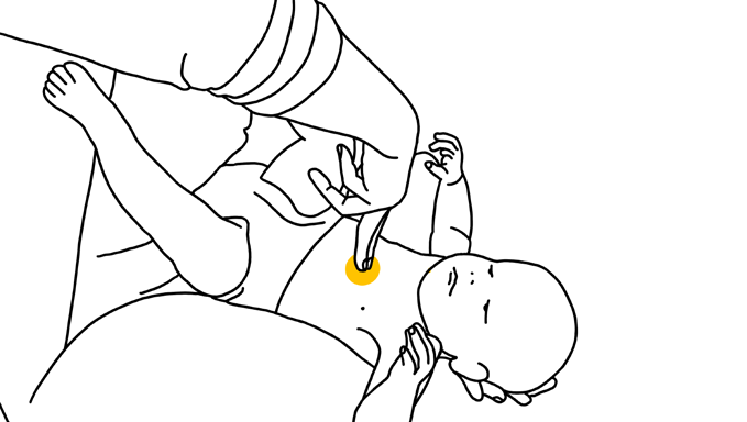Diagram 3: For infants, push just below the nipple
line with 2 fingers.