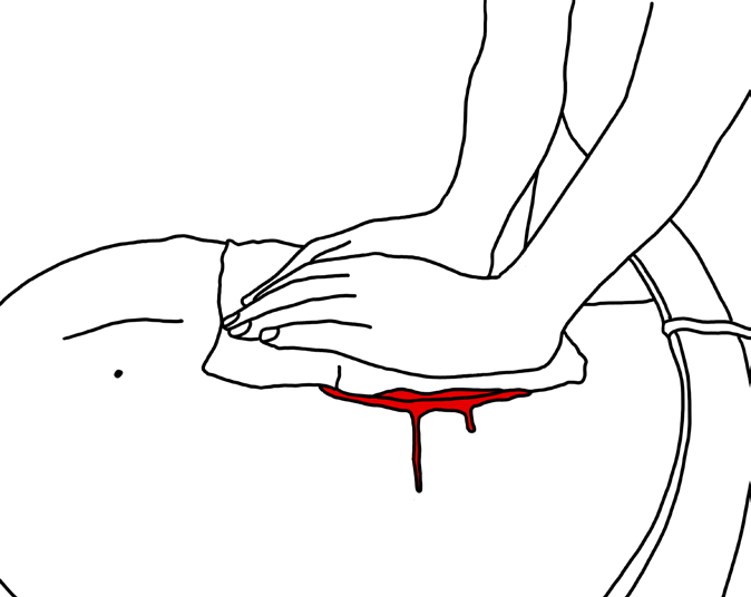 Diagram 9: Compress wound with both hands over clean cloth.